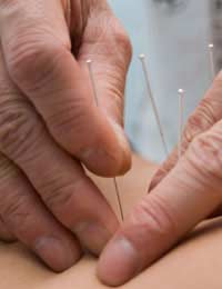 Hay Fever Acupuncture Alternative